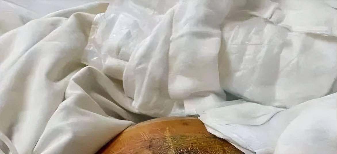鼻子做歪投诉多，上海芙若拉医疗美容曾涉百万医疗事故