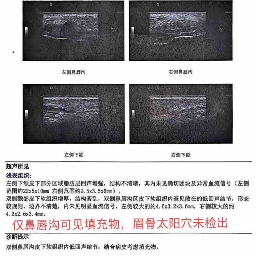 成都媛颂被爆长期违规使用医疗器械，求美者百万消费打水漂！