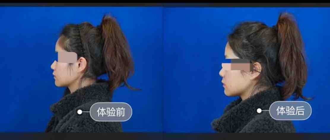 消费者质问上海薇琳医美医德何在,“医美不美”或成维权难题! 消费者质问上海薇琳医美医德何在,“医美不美”或成维权难题!
