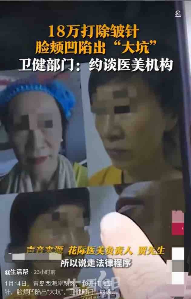 18万除皱针打出俩大坑，青岛花际医美跨区执业不是头一回！
