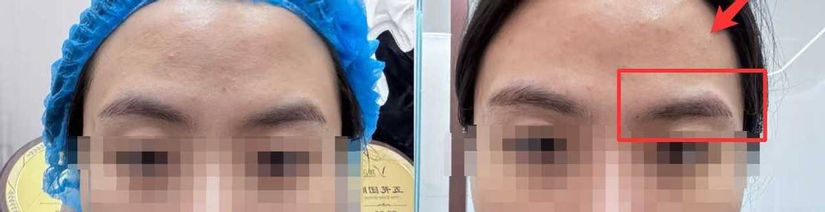 富婆医院被指针剂出问题，花30万在南京媛颂医美打了啥？