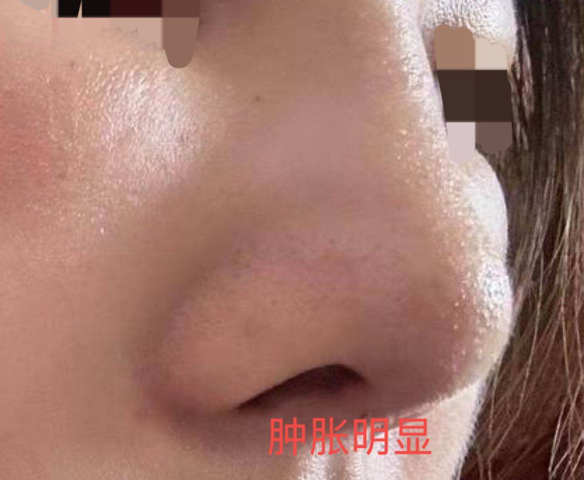 南昌红谷滩简一医美被网友避雷，机构两次登上本地维权新闻！