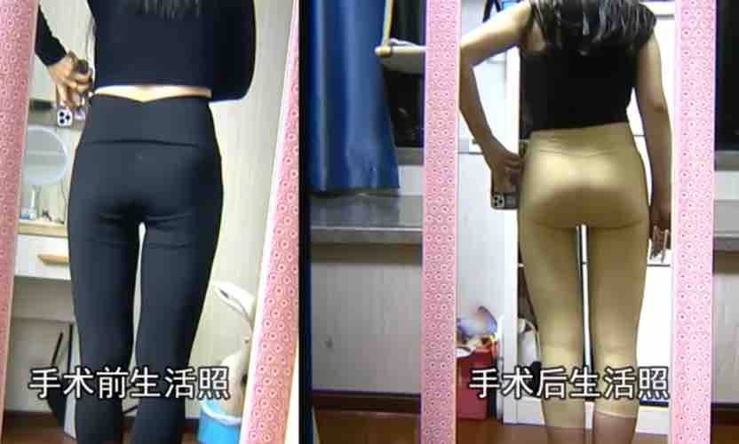 杭州静港医美再次登上电视维权,豪华医美集团真的靠谱吗? 杭州静港医美再次登上电视维权,豪华医美集团真的靠谱吗?