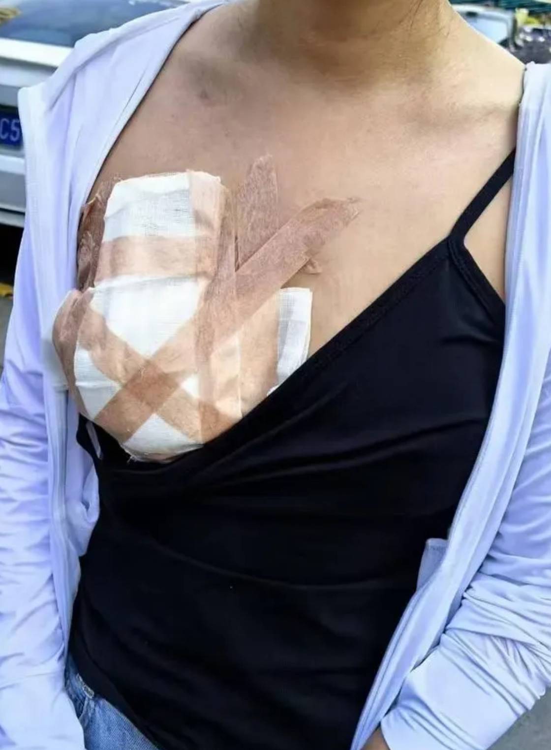 逆天的长沙铂丽瑞思医美!销售三无药品后又把消费者胸做烂了! 逆天的长沙铂丽瑞思医美!销售三无药品后又把消费者胸做烂了!