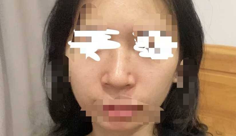广州美莱医疗美容被指注射妆字号水光针,医美安全谁来守护? 广州美莱医疗美容被指注射妆字号水光针,医美安全谁来守护?