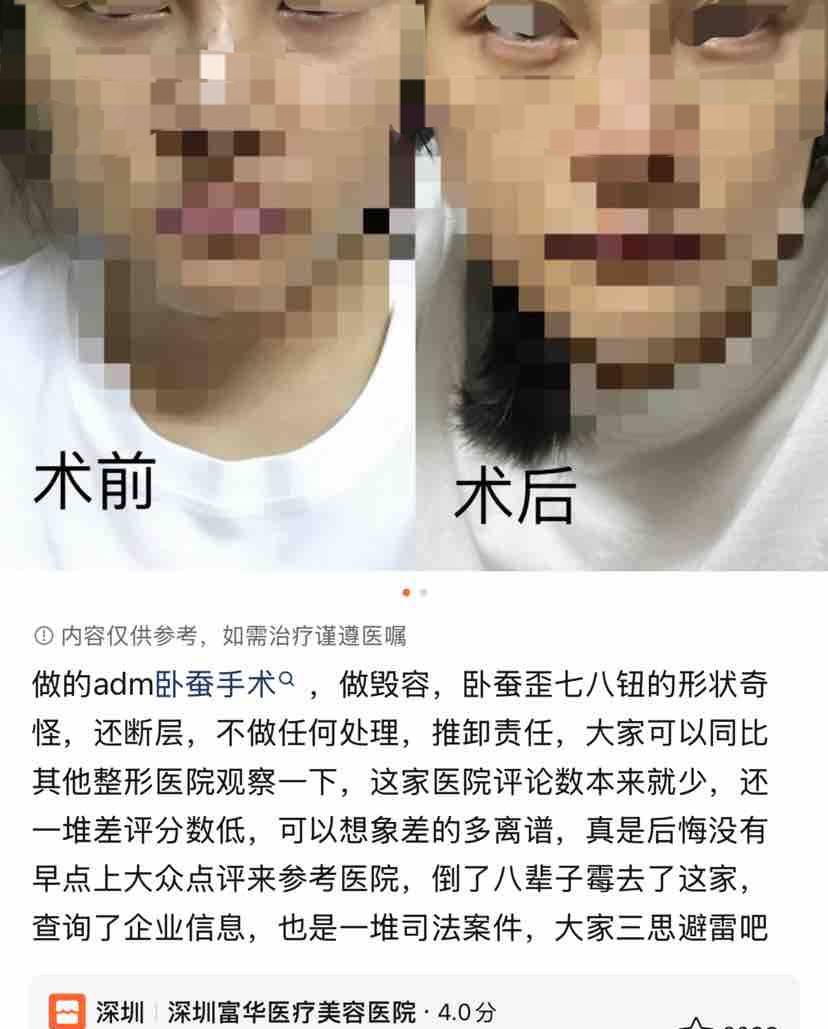 从深圳富华整形的违规诊疗,揭开尘封19载的奥美定之殇! 从深圳富华整形的违规诊疗,揭开尘封19载的奥美定之殇!