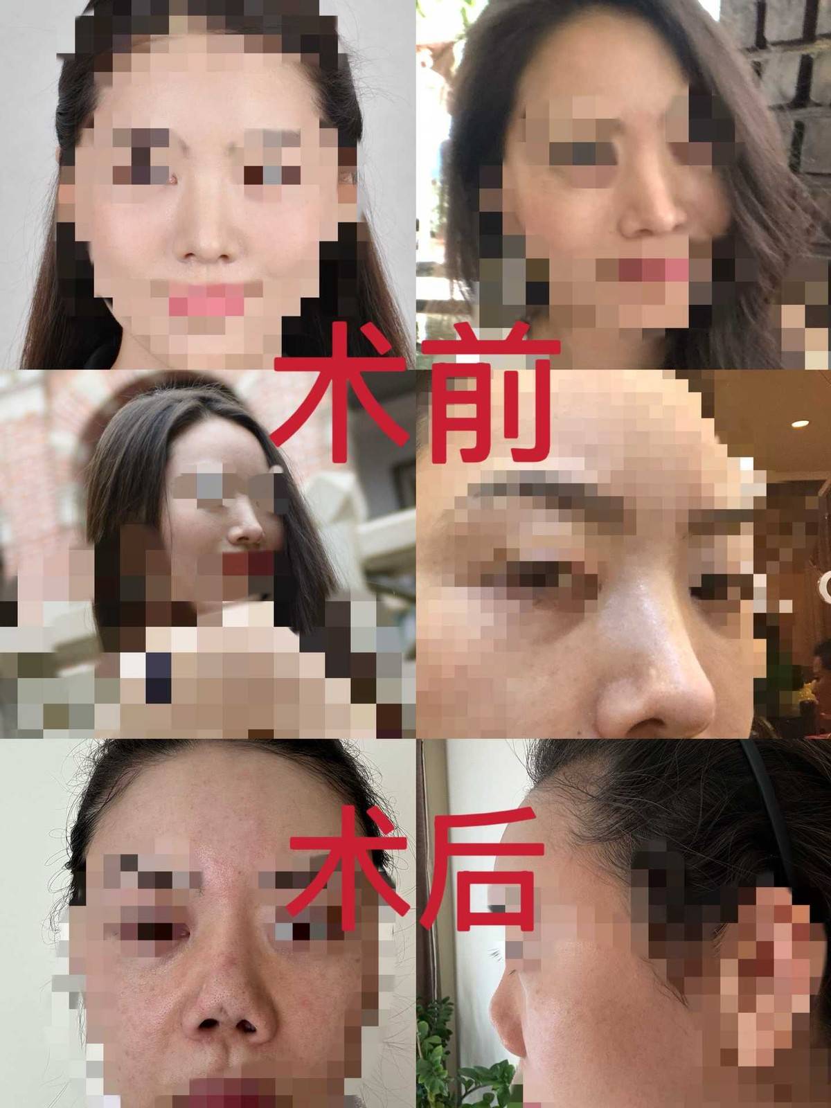 20年医德大拷问,消费者在北京俊泰美源维权遭辱骂殴打! 20年医德大拷问,消费者在北京俊泰美源维权遭辱骂殴打!