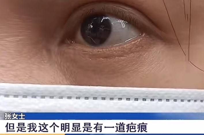 割个双眼皮也能“大出血”,南京星海荟医美维权退款难! 割个双眼皮也能“大出血”,南京星海荟医美维权退款难!