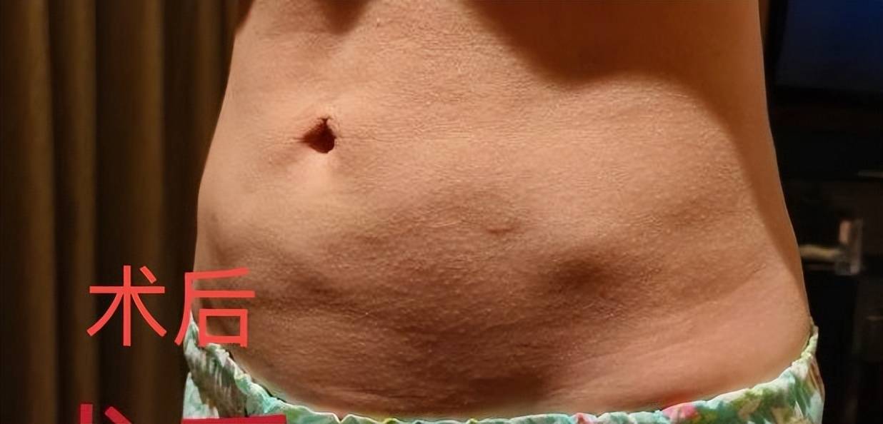 医美巨头销声匿迹,恶名远扬的北京伊美尔集团低调捞金 医美巨头销声匿迹,恶名远扬的北京伊美尔集团低调捞金