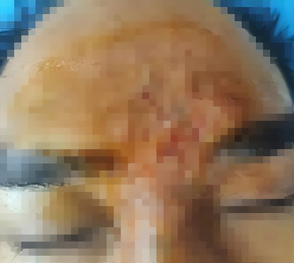 全网发布患者隐私的郑州星帜美歌，因医疗管理不善再度被罚！