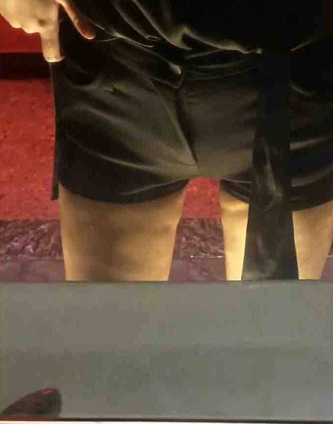 苏州康美医疗美容被消费者调侃,5A级机构吸脂术后效果差! 苏州康美医疗美容被消费者调侃,5A级机构吸脂术后效果差!