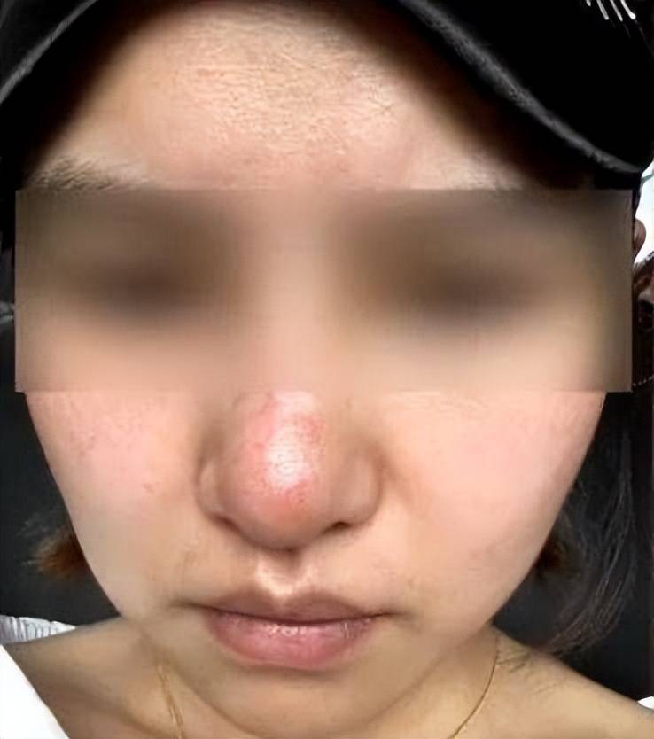 女子隆鼻失败欲维权，记者陪同却遭贵阳妍僖整形医院暴力阻拦