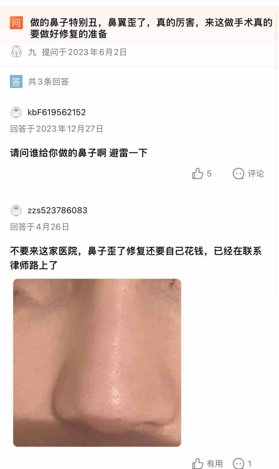 鼻子做歪投诉多，上海芙若拉医疗美容曾涉百万医疗事故