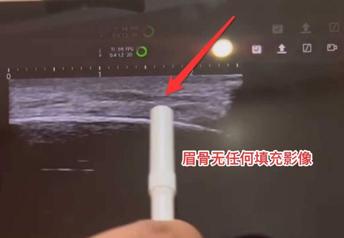 富婆医院被指针剂出问题，花30万在南京媛颂医美打了啥？