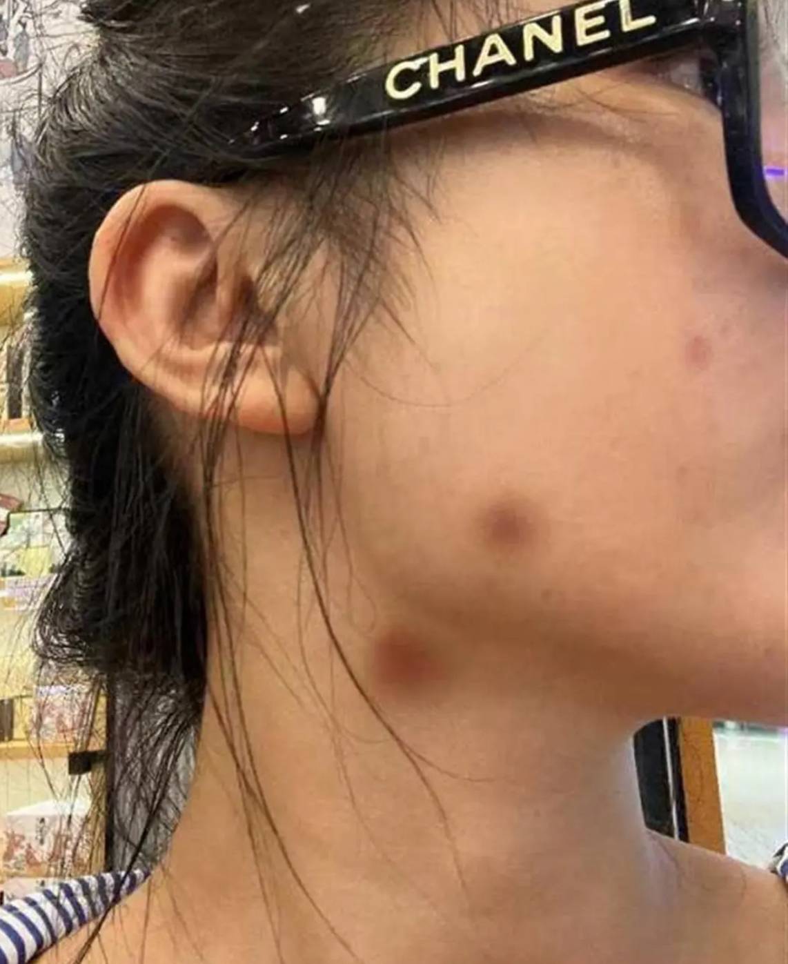 消费近13万做医美却被层层转卖了？南昌咏泰医美葫芦里卖的什么药？