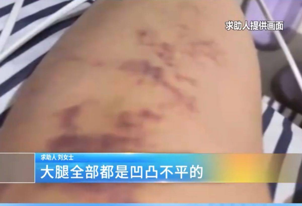 维权反指被敲诈,河南天韵医美曾涉诱导消费事件尚未说清 维权反指被敲诈,河南天韵医美曾涉诱导消费事件尚未说清