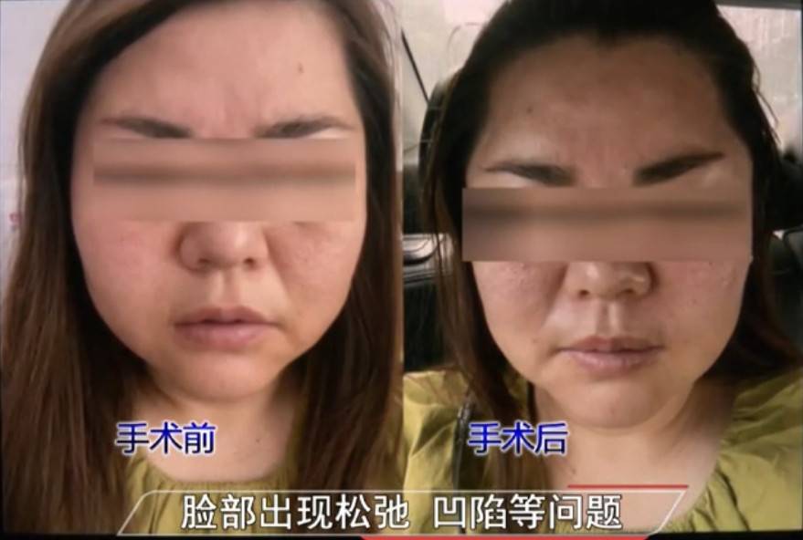 南昌微美甄美变身同一济甄美医美，后者曾涉“妈见怕”整形纠纷