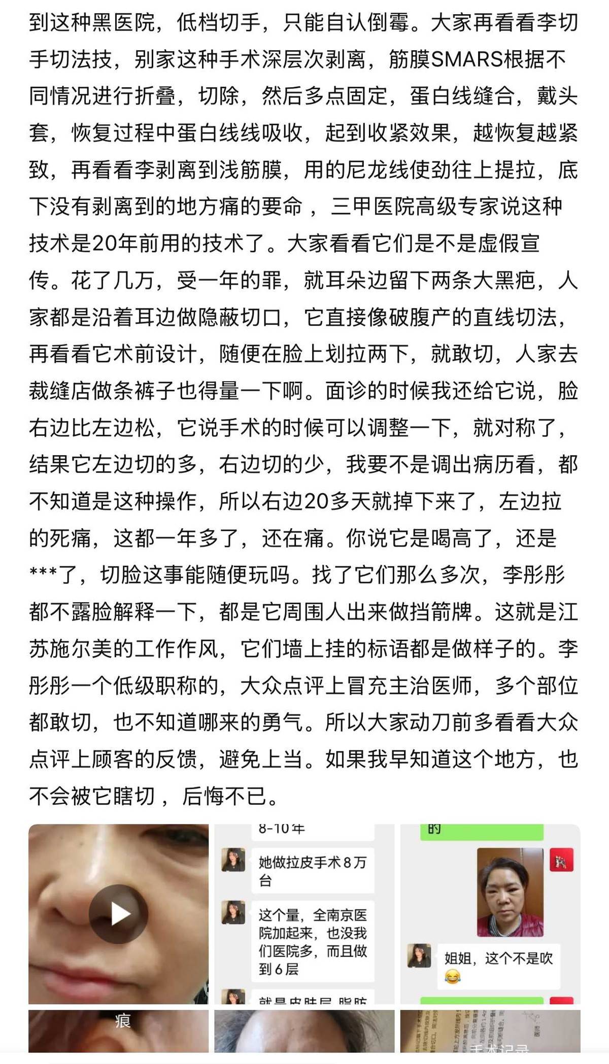 消费者手术悄悄“被降级”,江苏施尔美整形吹太离谱算不算虚假宣传? 消费者手术悄悄“被降级”,江苏施尔美整形吹太离谱算不算虚假宣传?