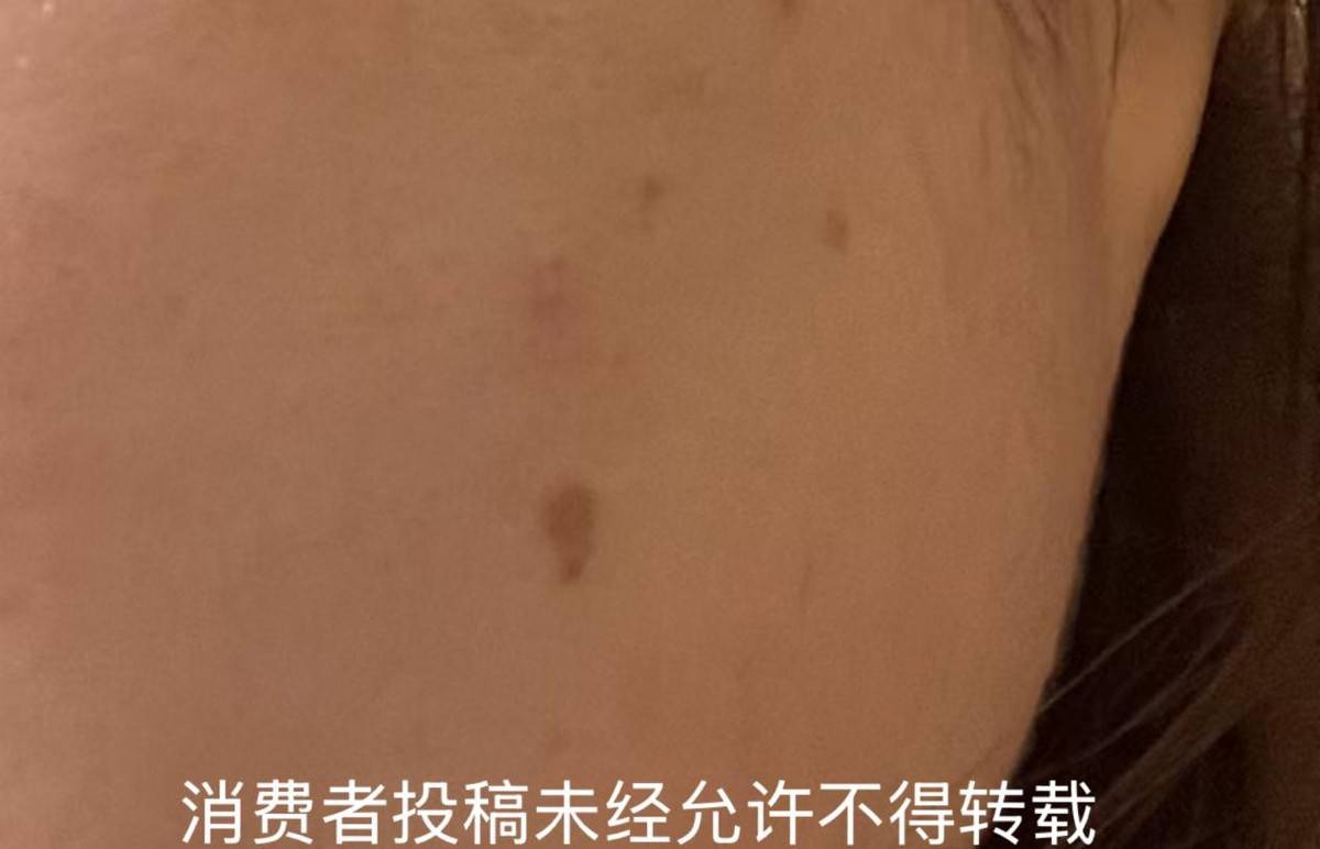 违规注射针剂后关门，南京秦淮芳华悦初医美是一家