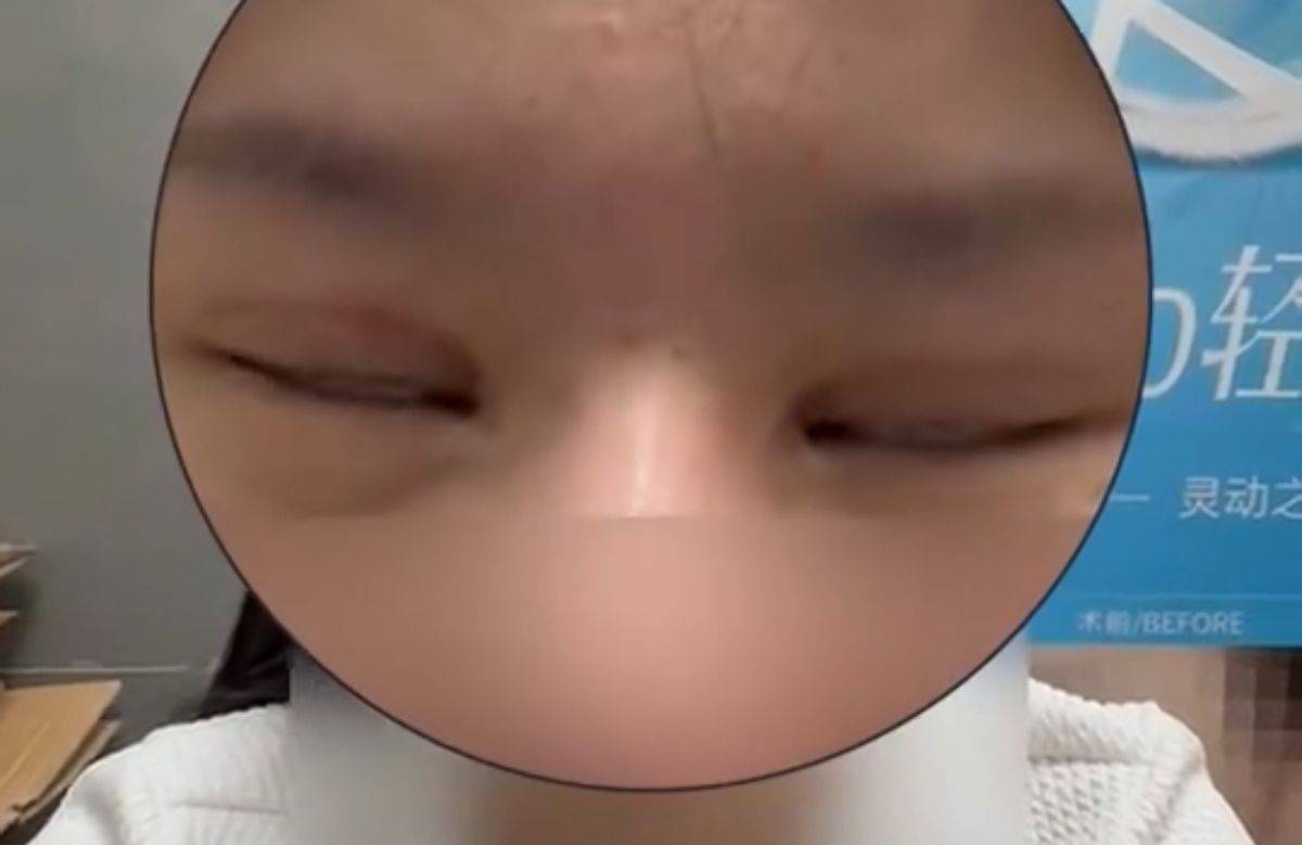 鼻子做歪投诉多，上海芙若拉医疗美容曾涉百万医疗事故