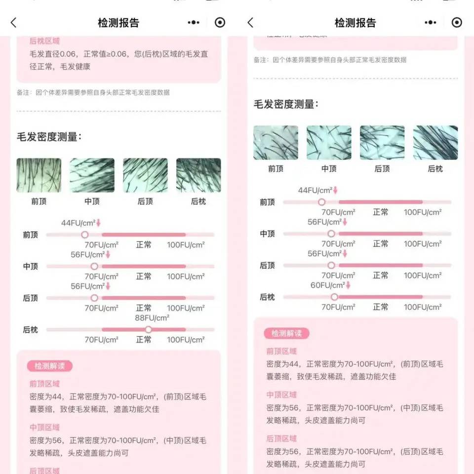 植发后不如不植？新京报曝雍禾医疗存活率五大保障履约难