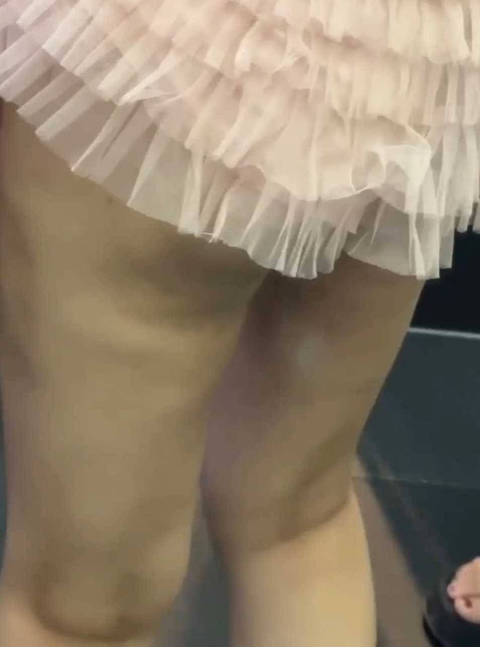 苏州康美医疗美容被消费者调侃,5A级机构吸脂术后效果差! 苏州康美医疗美容被消费者调侃,5A级机构吸脂术后效果差!