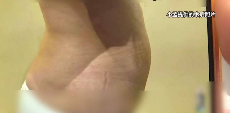 杭州静港医美再次登上电视维权,豪华医美集团真的靠谱吗? 杭州静港医美再次登上电视维权,豪华医美集团真的靠谱吗?