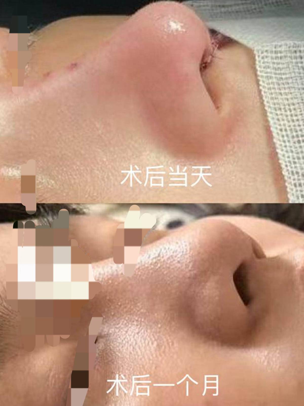 南昌红谷滩简一医美被网友避雷，机构两次登上本地维权新闻！