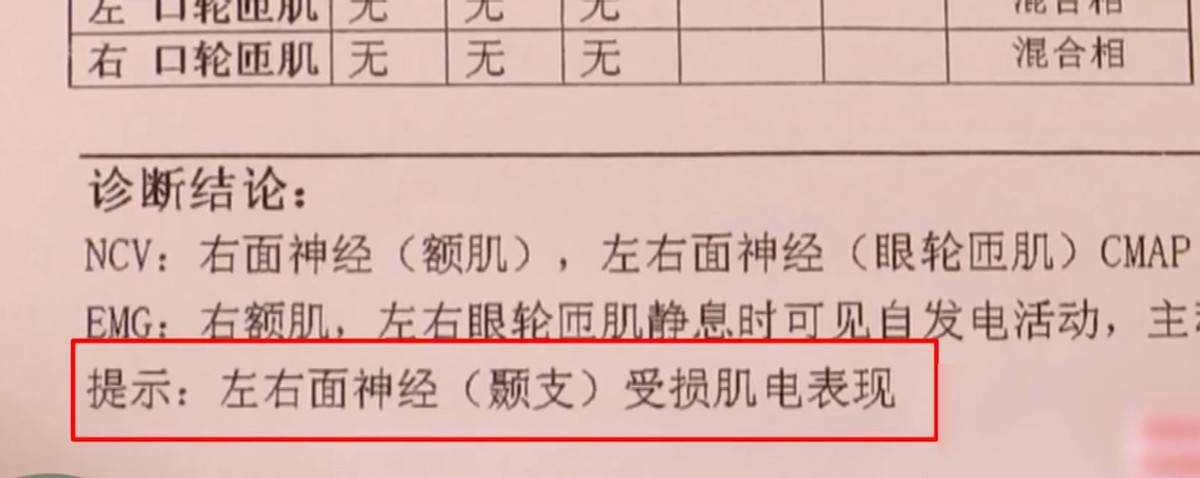 拉皮后眉毛不能动，宁波鄞州童颜医疗美容黑历史洗白难！