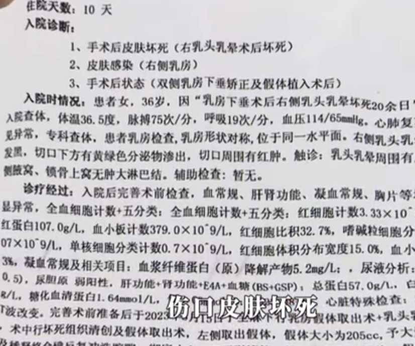 女子称在湖南雅美医美隆胸后胸部像石头,导致两任男友均分手 女子称在湖南雅美医美隆胸后胸部像石头,导致两任男友均分手