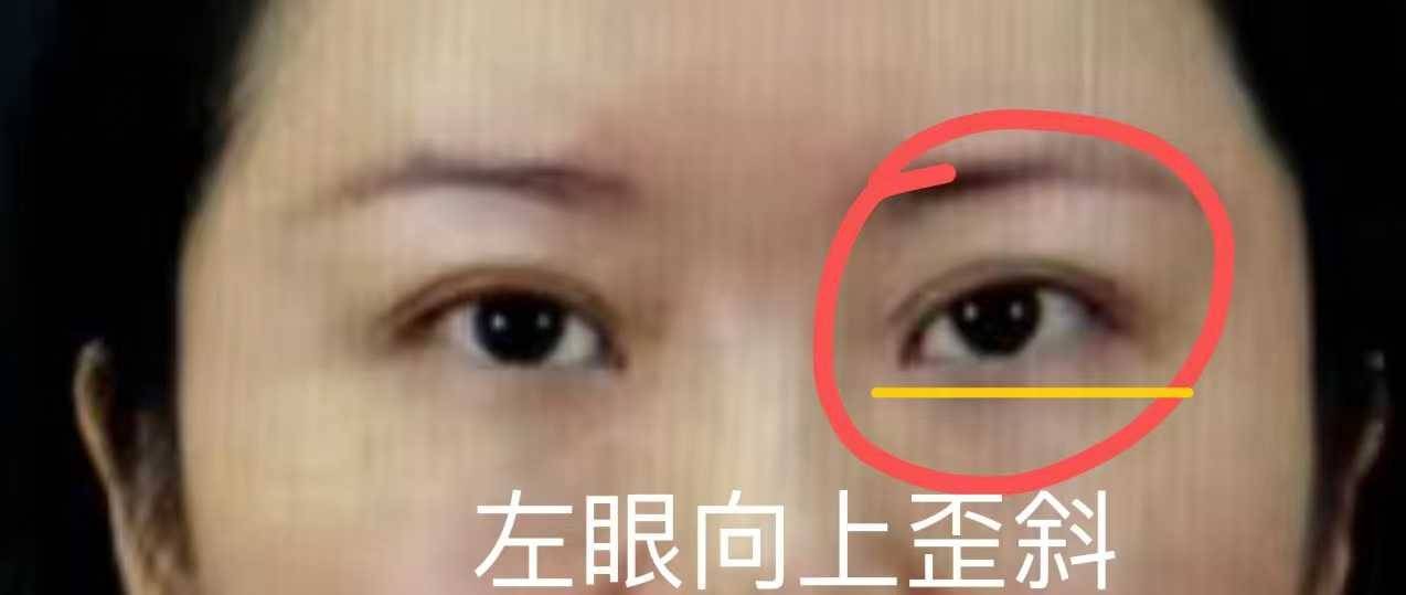 医美圈滴血劫财卷土重来?杭州时光医疗美容莆系旧习何时能改? 医美圈滴血劫财卷土重来?杭州时光医疗美容莆系旧习何时能改?