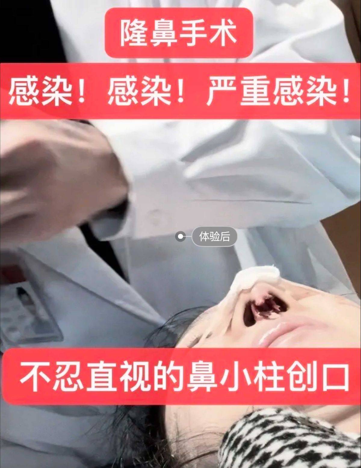 消费者质问上海薇琳医美医德何在,“医美不美”或成维权难题! 消费者质问上海薇琳医美医德何在,“医美不美”或成维权难题!