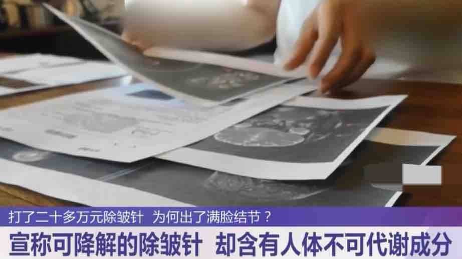20多万针剂打坏一张脸,南京连天美医疗美容药品来源成迷 20多万针剂打坏一张脸,南京连天美医疗美容药品来源成迷