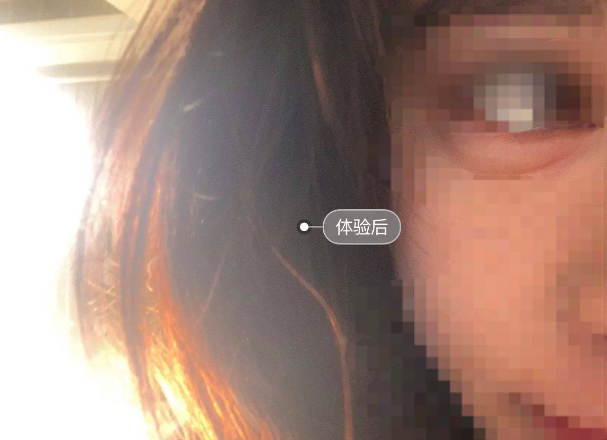拉皮后眉毛不能动，宁波鄞州童颜医疗美容黑历史洗白难！