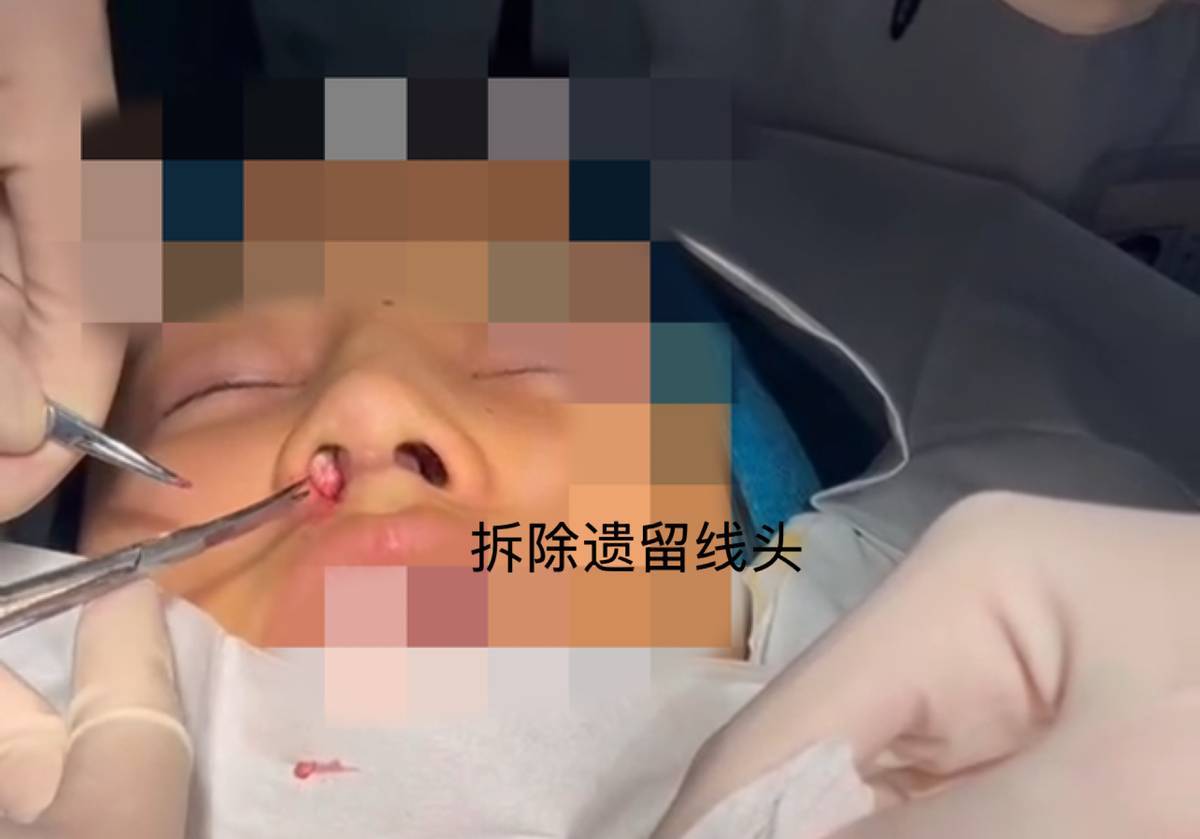 南昌红谷滩简一医美被网友避雷，机构两次登上本地维权新闻！